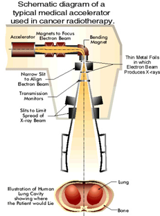 Schematic diagram of a typical medical accelerator used in cancer radiotherapy.